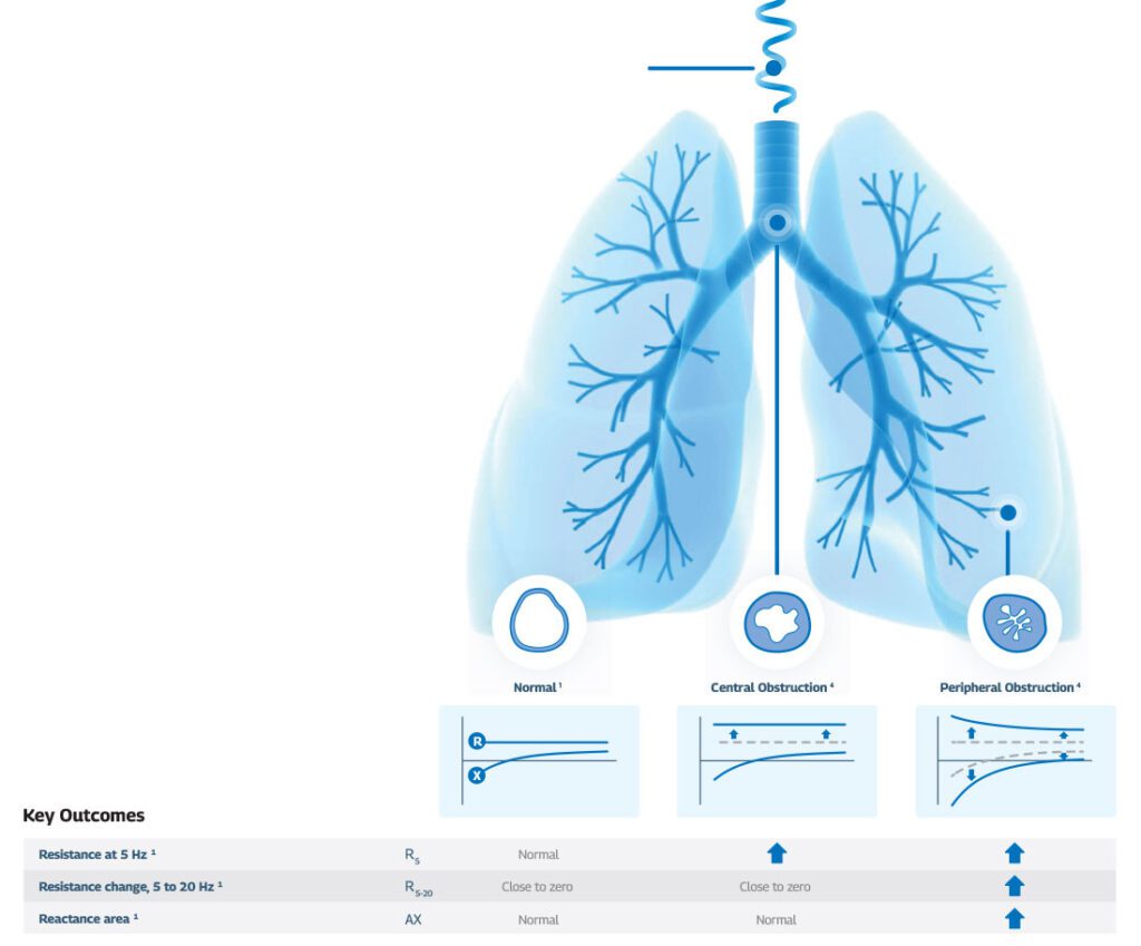 GANSHORN tremoflo | Innovative pulmonary function device
